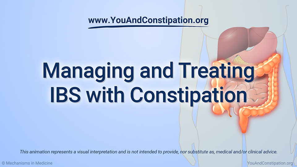 Animation - Managing and Treating IBS-C