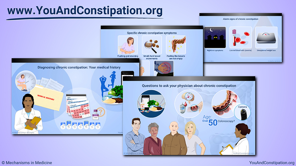 Slide Show - Diagnosing Chronic Constipation