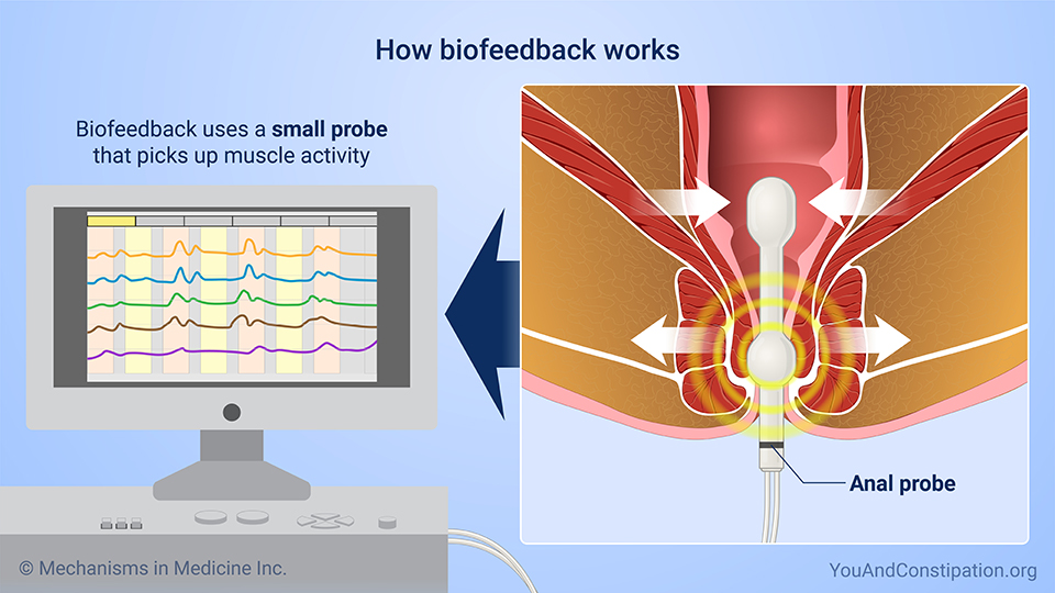 How biofeedback works