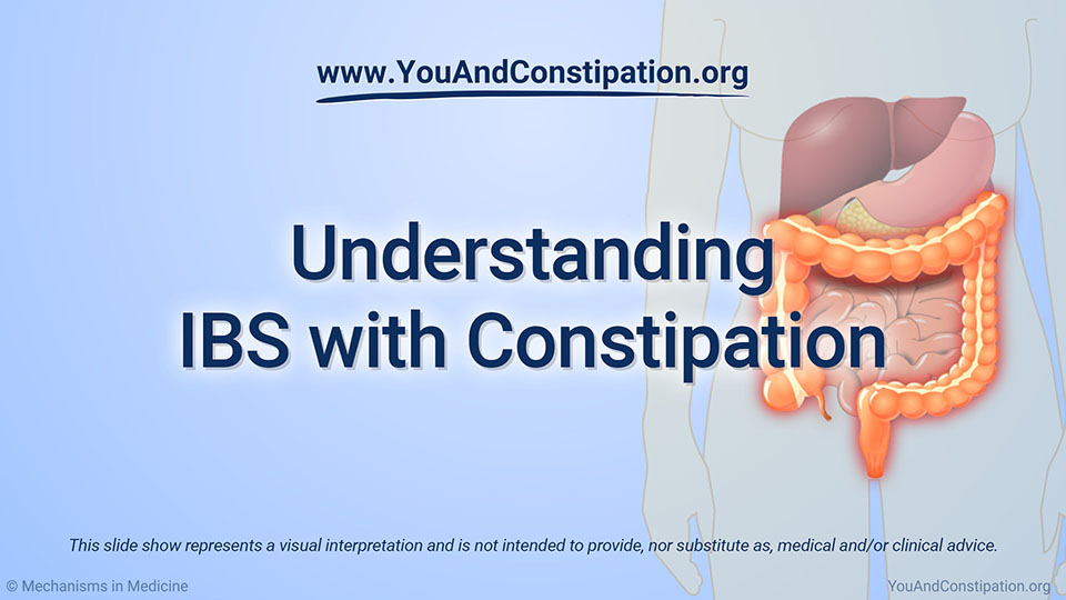 Slide Show Understanding IBS with Constipation