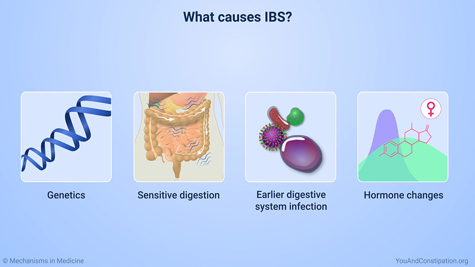 What causes IBS?