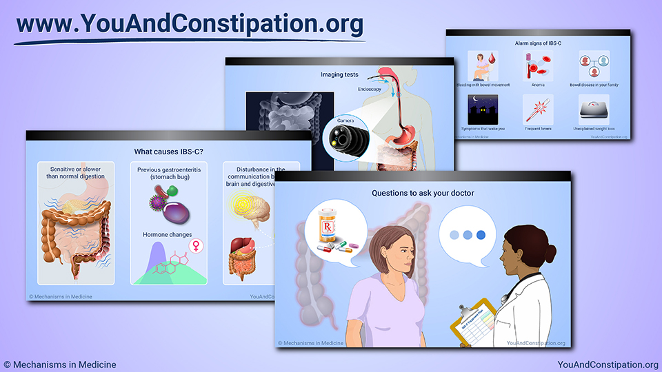 Slide Show - Diagnosing IBS-C