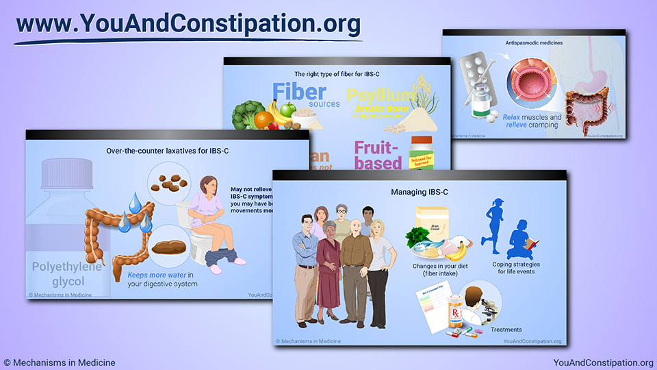 Slide Show - Managing and Treating IBS-C