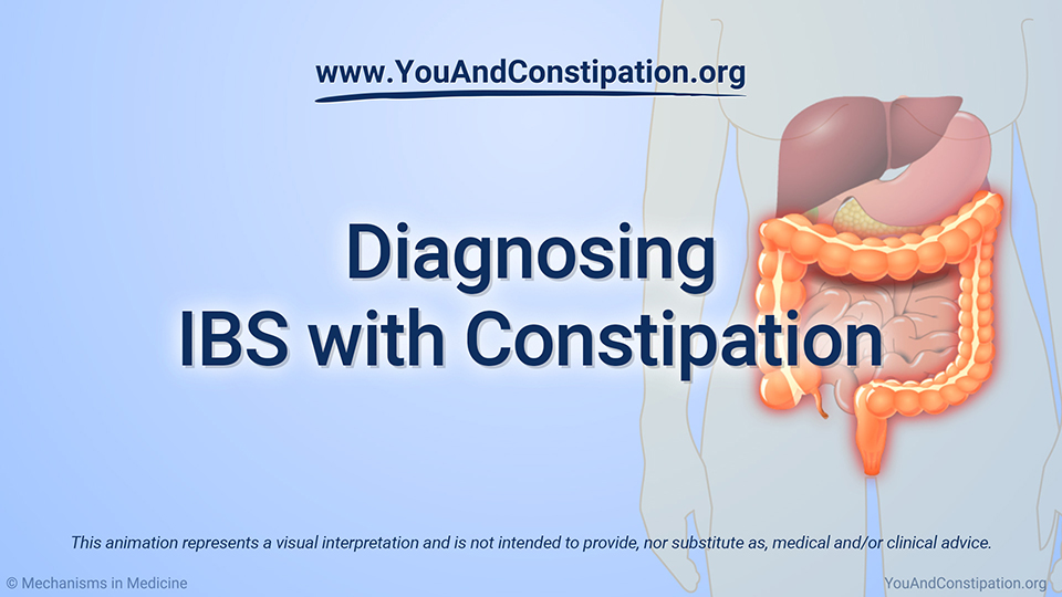 Animation - Diagnosing IBS-C