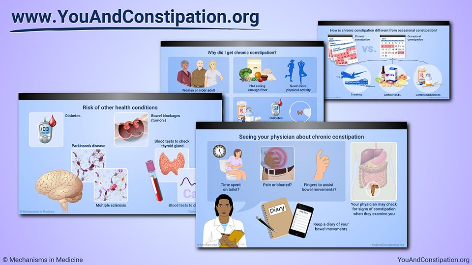 Slide Show - Understanding Chronic Constipation