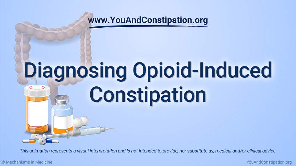 Animation - Diagnosing OIC