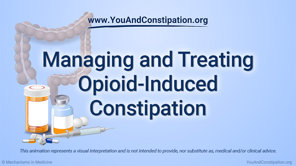 Animation - Managing and Treating OIC