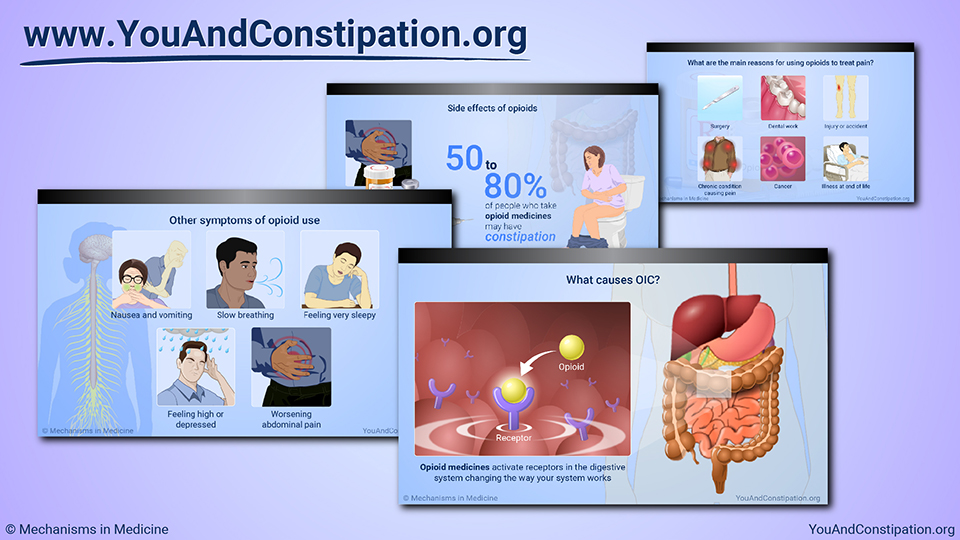 Slide Show - Understanding OIC
