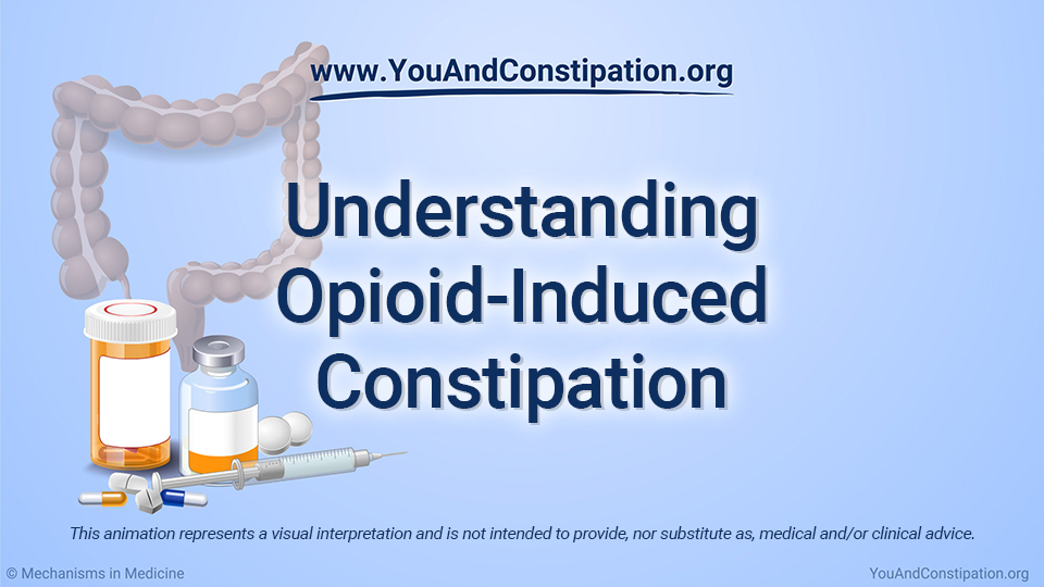 Understanding Opioid-Induced Constipation (OIC)