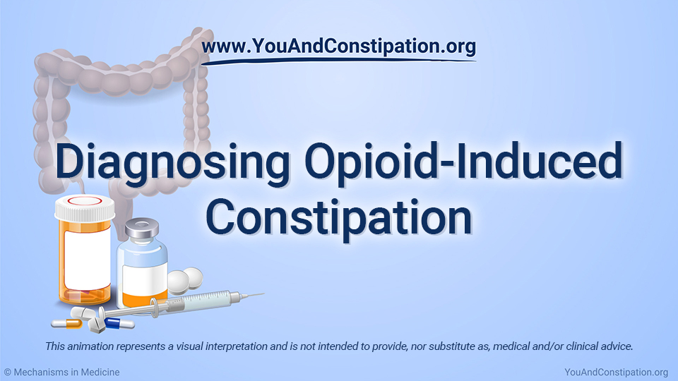 Diagnosing Opioid-Induced Constipation