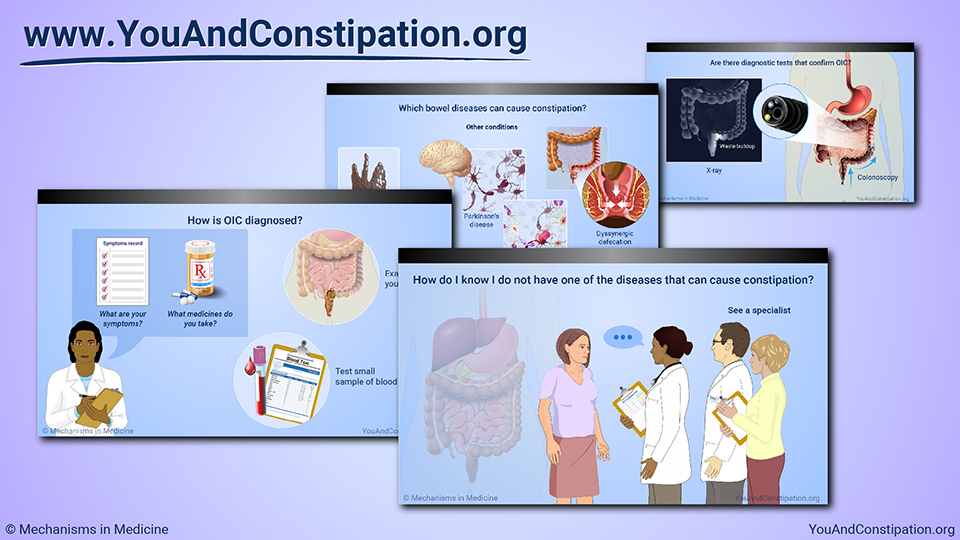 Diagnosing Opioid-Induced Constipation