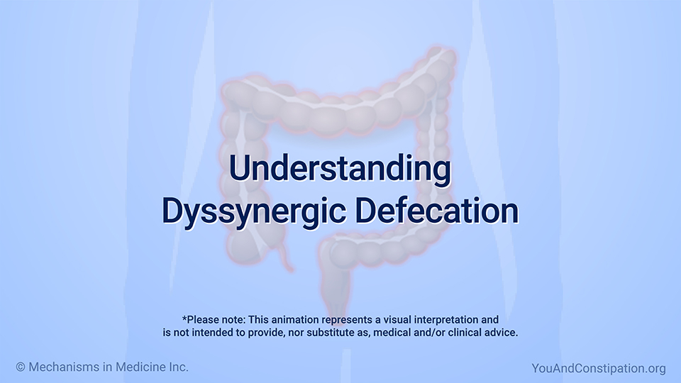 Animation - Understanding Dyssynergic Defecation