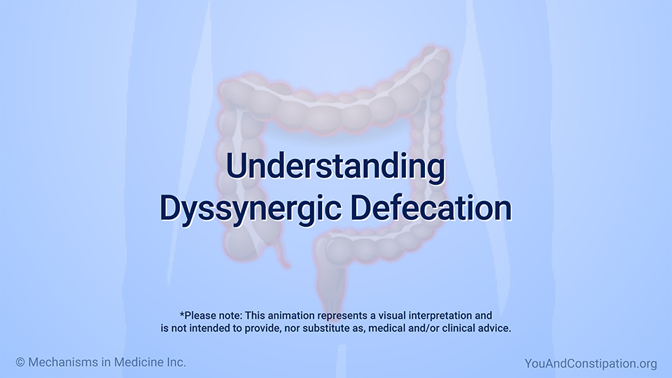 Animation - Understanding Dyssynergic Defecation