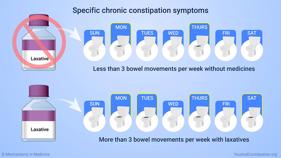 Specific chronic constipation symptoms