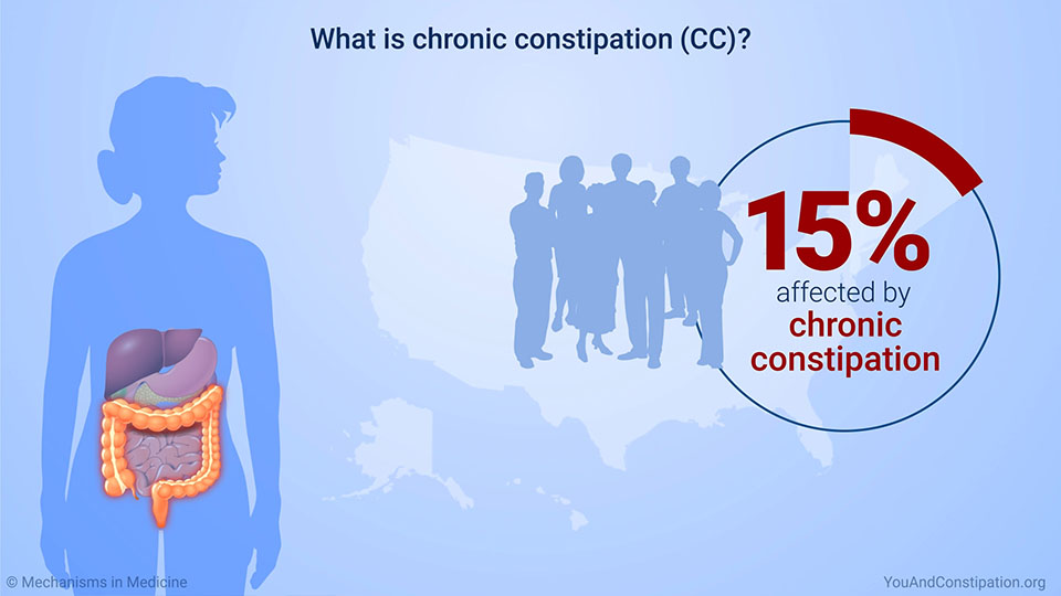 What is chronic constipation (CC)?