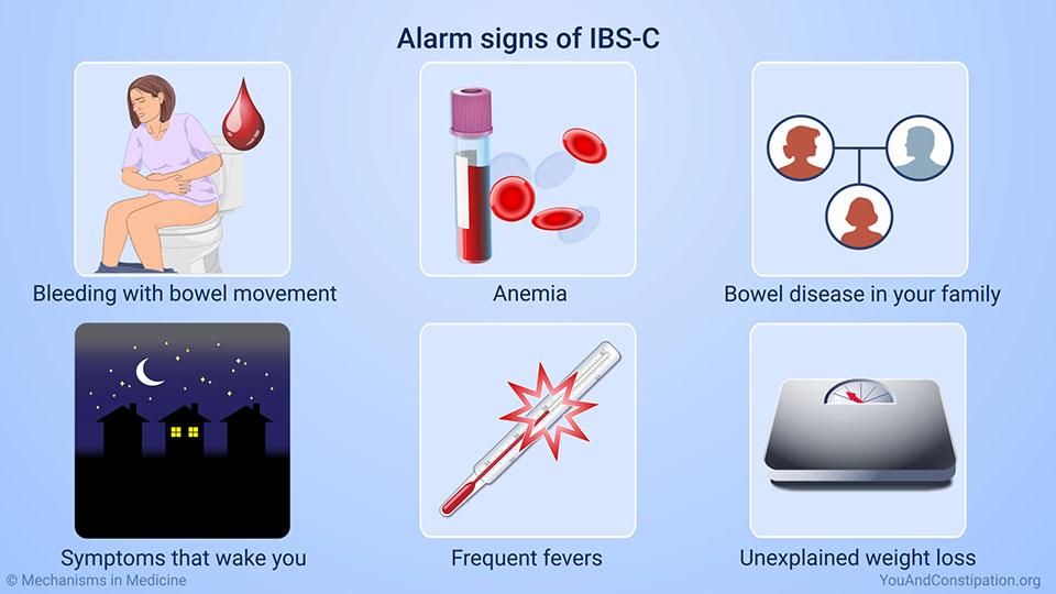 Alarm signs of IBS-C