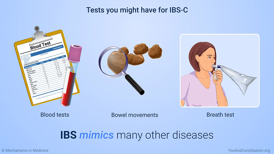 Tests you might have for IBS-C