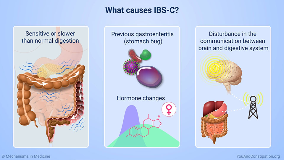 What causes IBS-C?