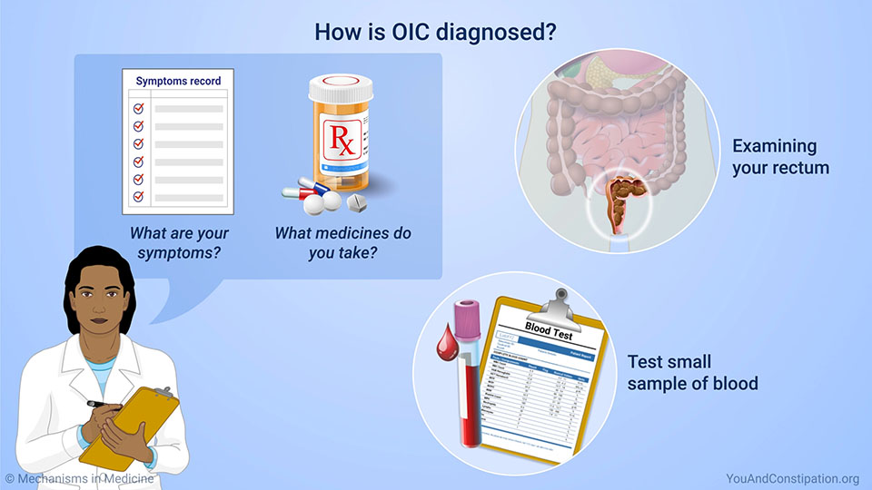 How is OIC diagnosed?