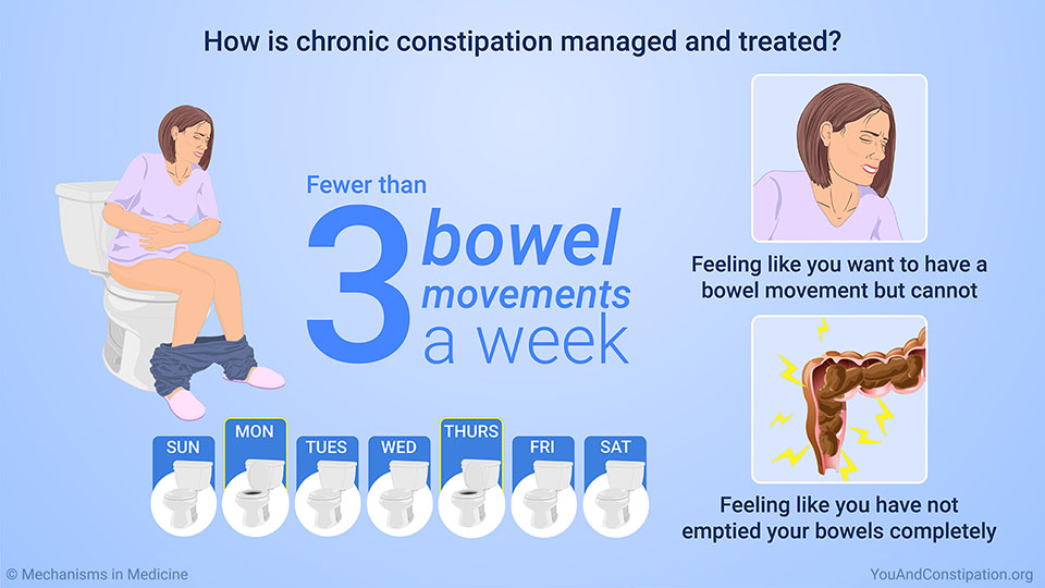 How is chronic constipation managed and treated?