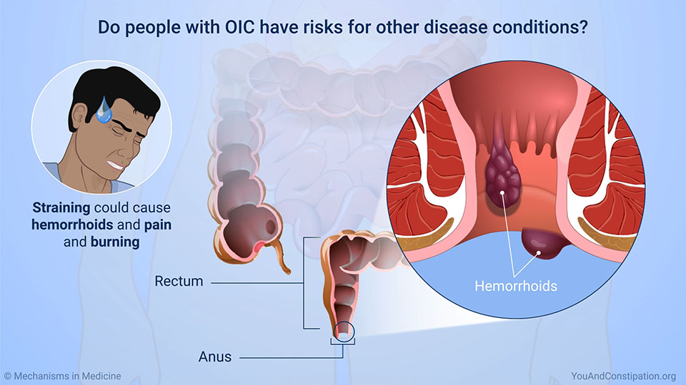 Do people with OIC have risks for other disease conditions?