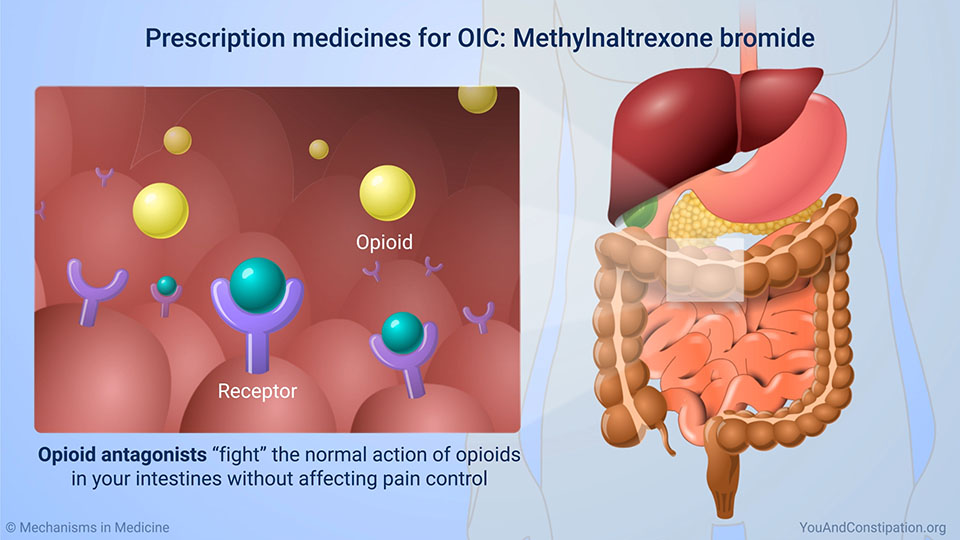 Prescription medicines for OIC: Methylnaltrexone bromide