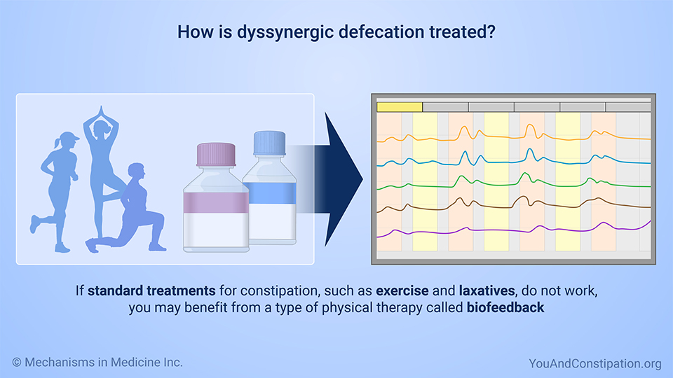 How is dyssynergic defecation treated?