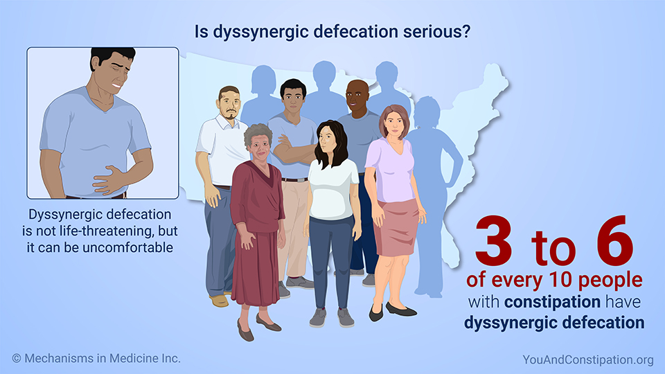 Is dyssynergic defecation serious?
