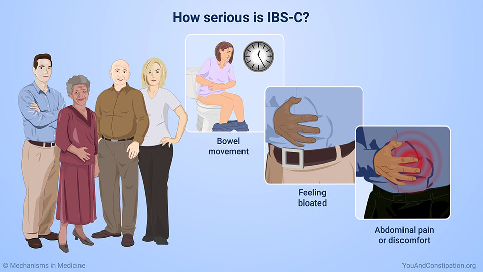 How serious is IBS-C?