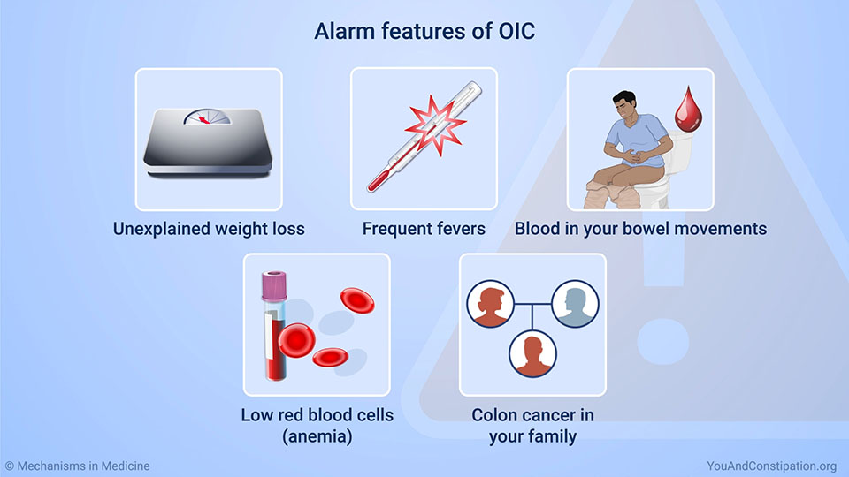 Alarm features of OIC