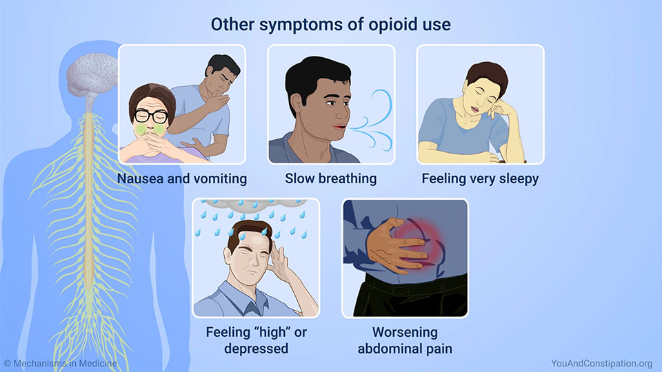 Other symptoms of opioid use