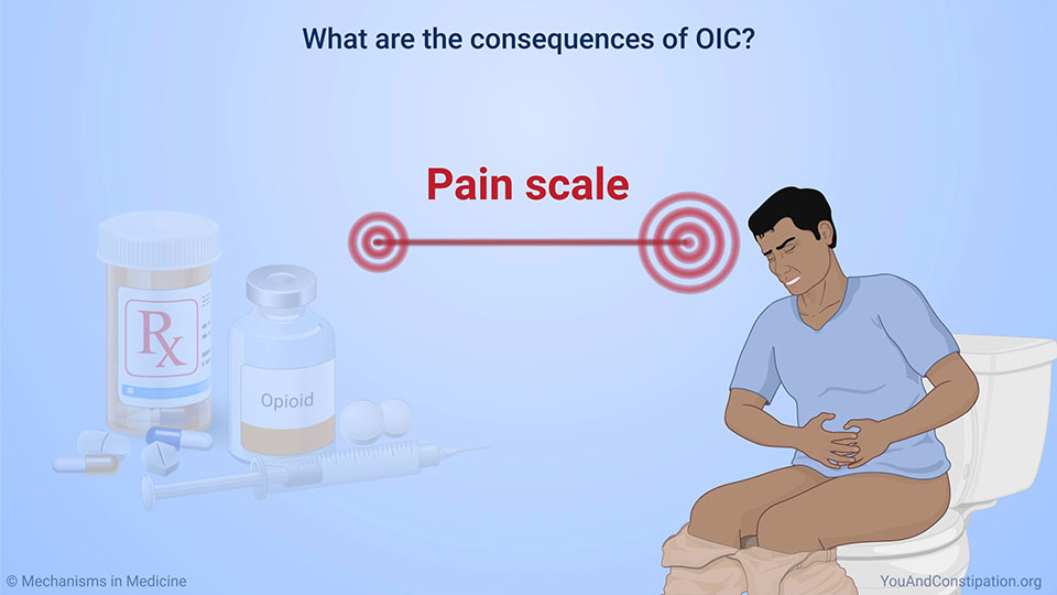 What are the consequences of OIC?