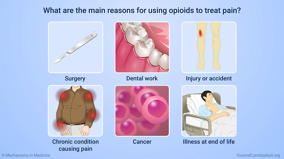 What are the main reasons for using opioids to treat pain?