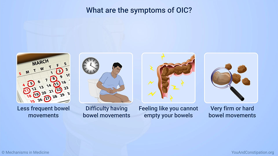 What are the symptoms of OIC?