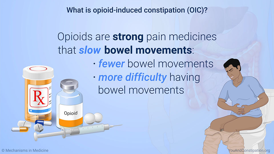 What is opioid-induced constipation (OIC)?